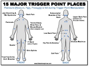 triggerpoints